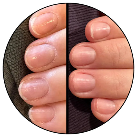 Cuticle Oil